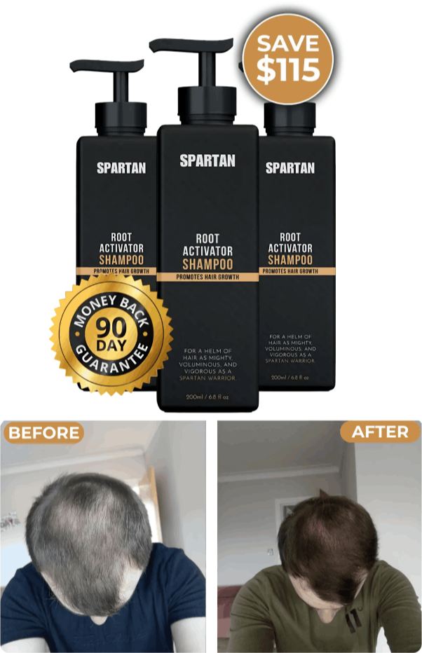 What is Spartan Shampoo